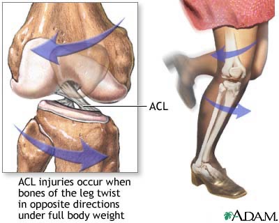 ACL_Injure